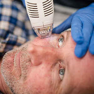Tixel Skin Tightening and Rejuvenation